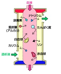 ダイアライザーの構造